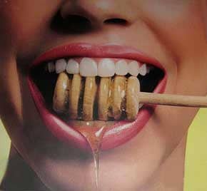 درمان بیماری های دهان و دندان با عسل 