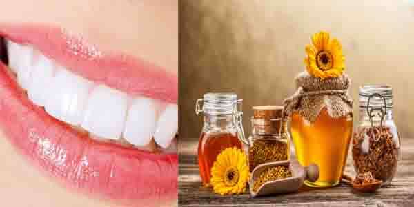 درمان بیماری های دهان و دندان با عسل
